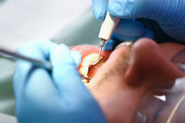 Best Emergency Broken Tooth Repair in North Merritt Island, FL